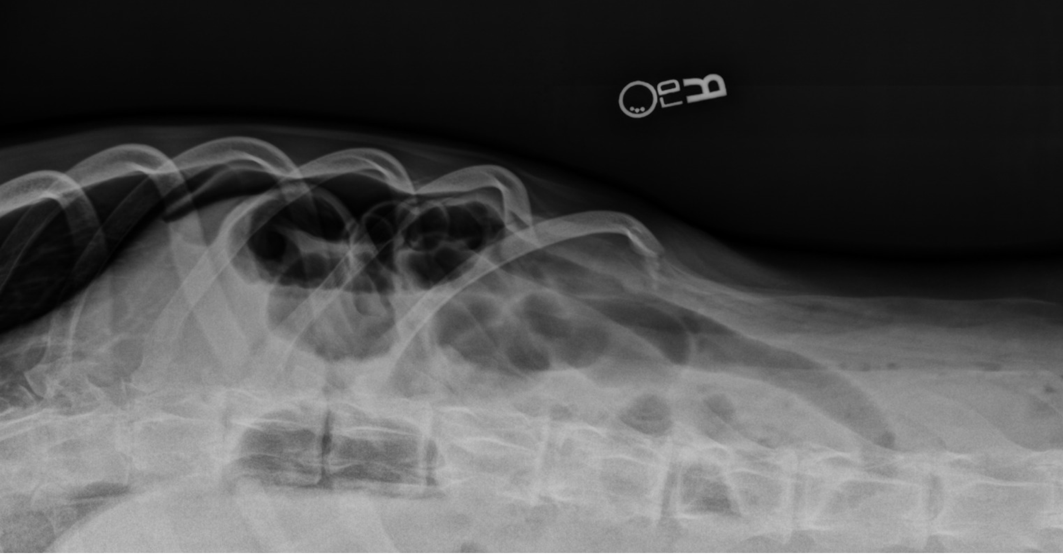 Radiograph using the beads to describe orientation. Which way is down matters more