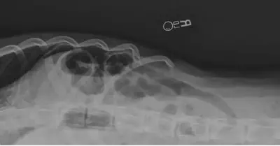Radiograph using the beads to describe orientation. Which way is down matters more
